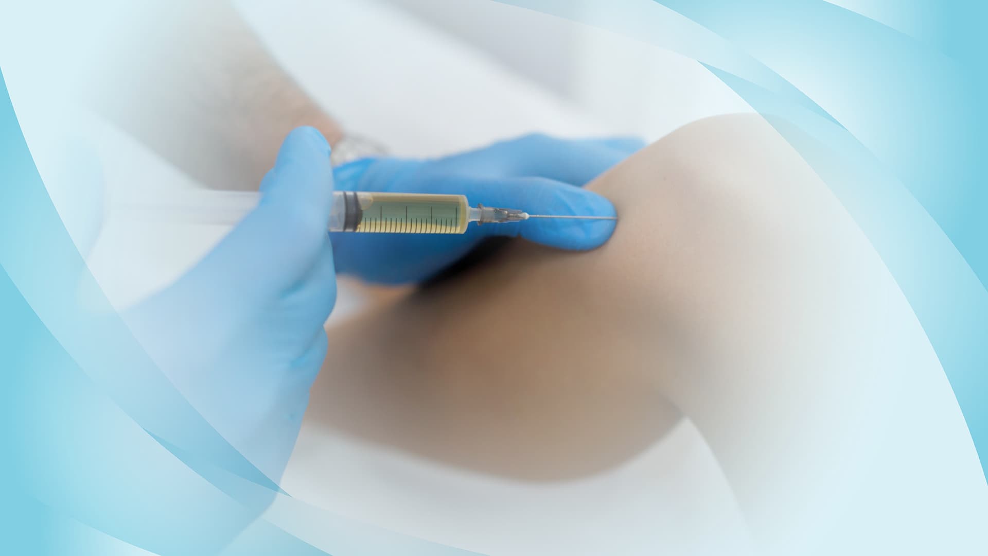 Arthrosamid® Injection Cost Unveiled: A Clear Guide for Patients