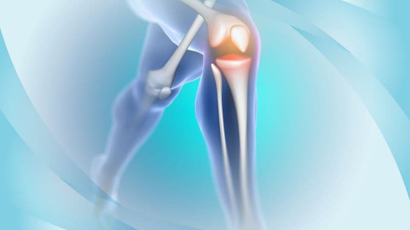 Modernizing Knee Osteoarthritis Diagnosis: How Certainty Factor Models Are Enhancing Traditional Imaging