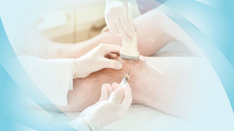 Arthrosamid® Cost: Is This Knee Pain Treatment Worth It?