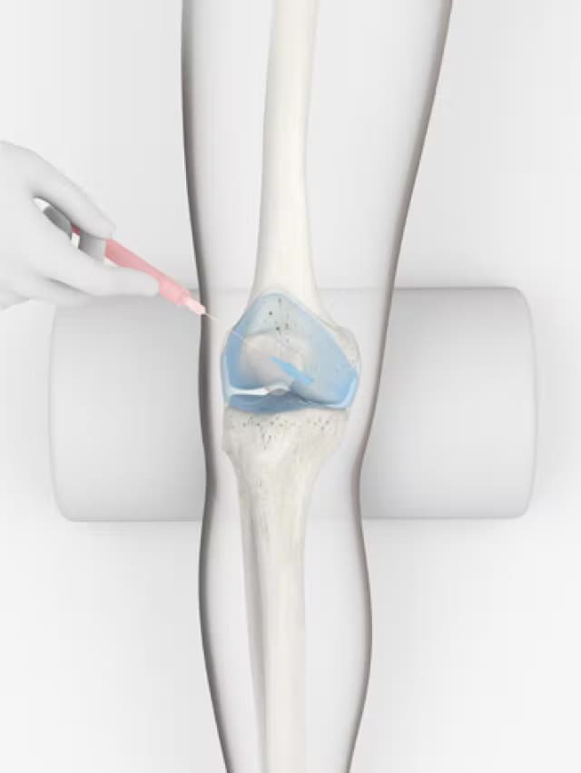 The latest medical technology for osteoarthritis | AMSK Clinic