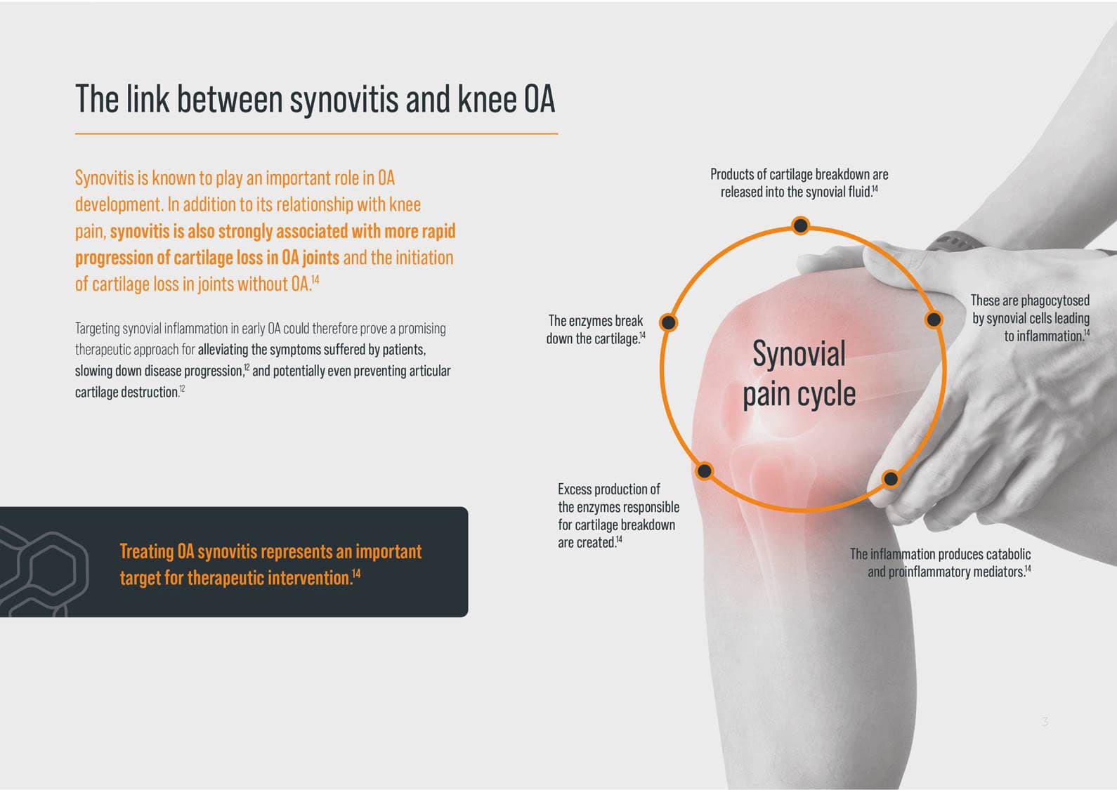 The link between synovitis and knee osteoarthritis