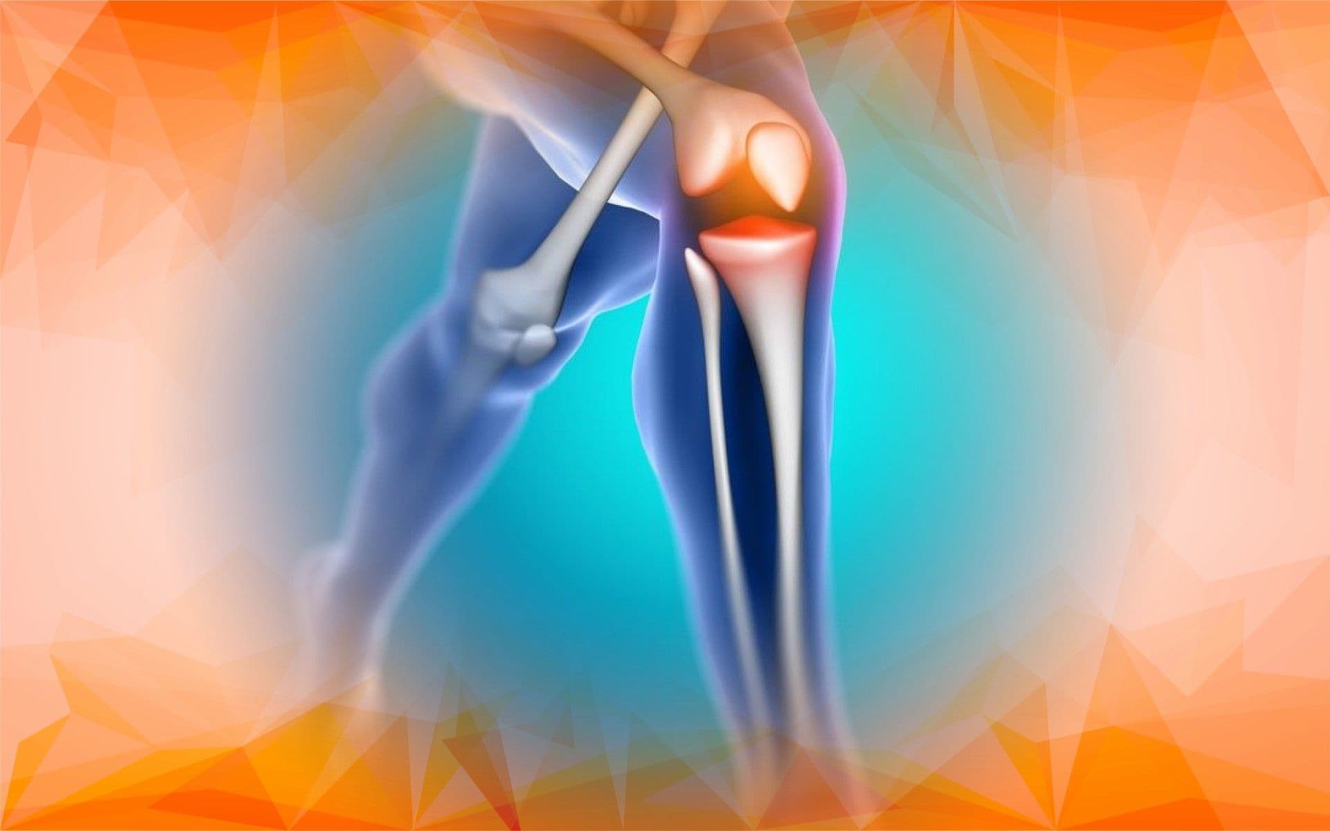 Modernizing Knee Osteoarthritis Diagnosis: How Certainty Factor Models Are Enhancing Traditional Imaging